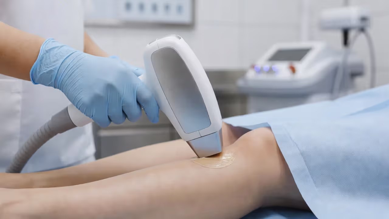 Professional laser hair removal treatment being performed in a dermatology clinic setting
