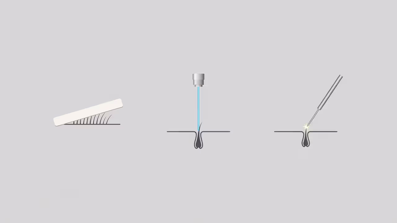Comparison of waxing, laser, and electrolysis hair removal methods