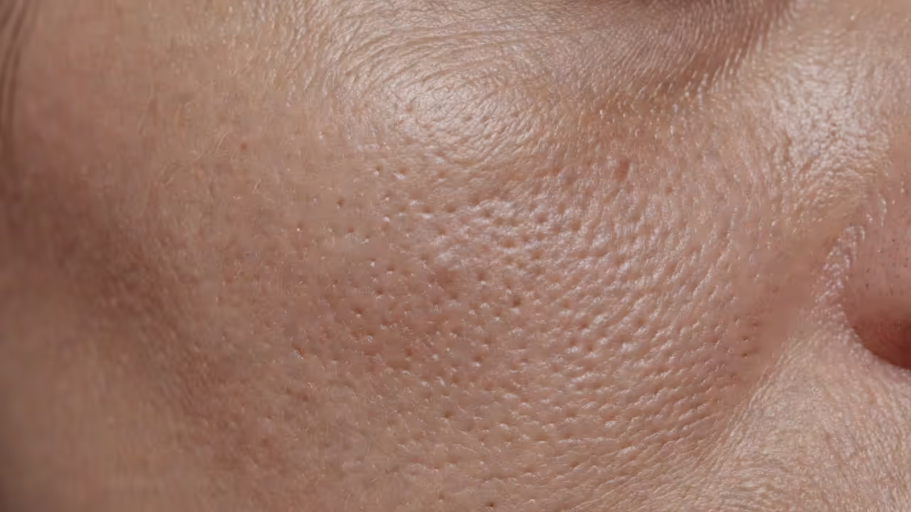 Macro close-up of textured facial skin showing visible pore openings and surface irregularities