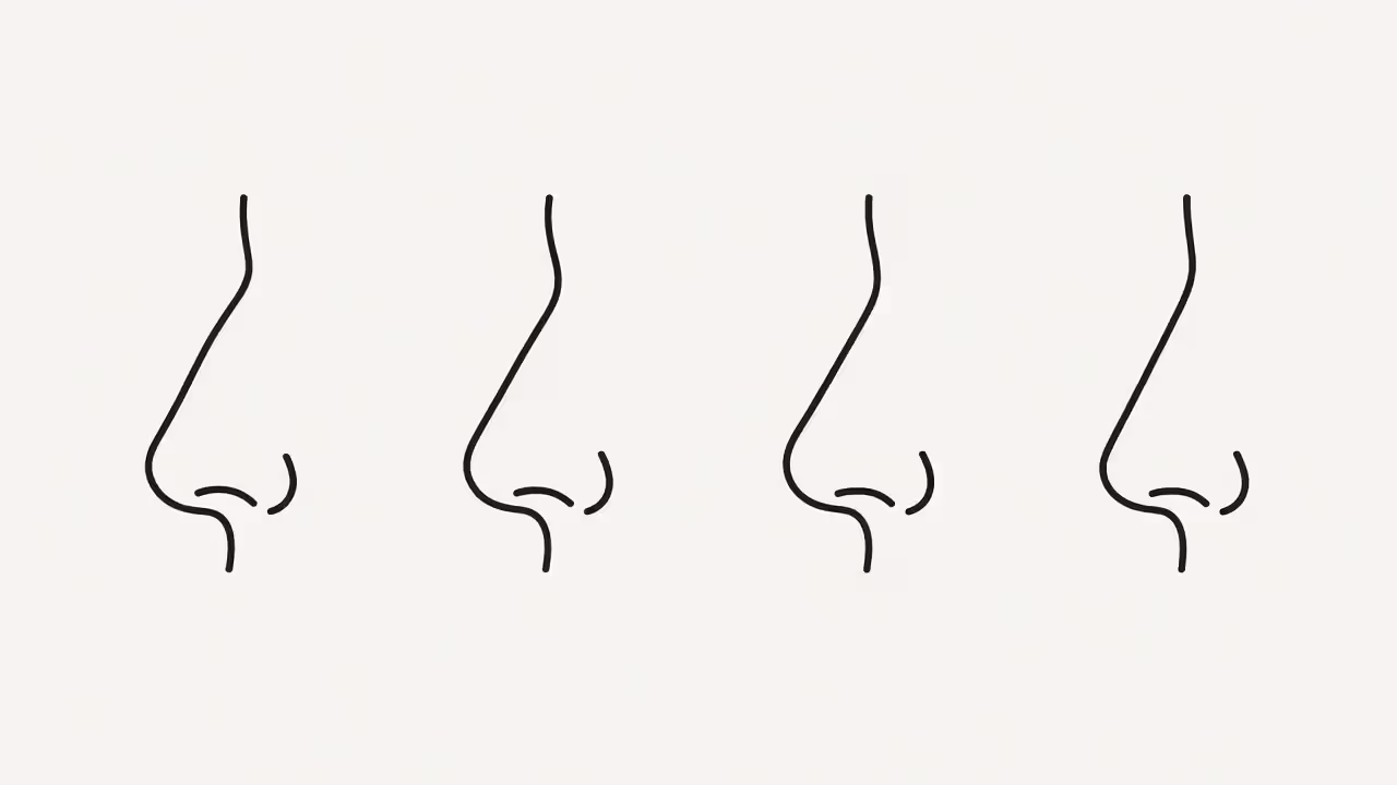 Side profile comparison of different nose shapes including dorsal hump and turned up nose